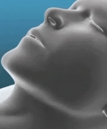 SomniGuard™ – Dispositivo de Alineación Respiratoria Nocturna